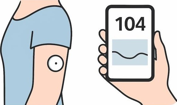 リアルタイムCGM