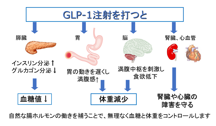 GLP-1受容体作動薬とインスリン療法