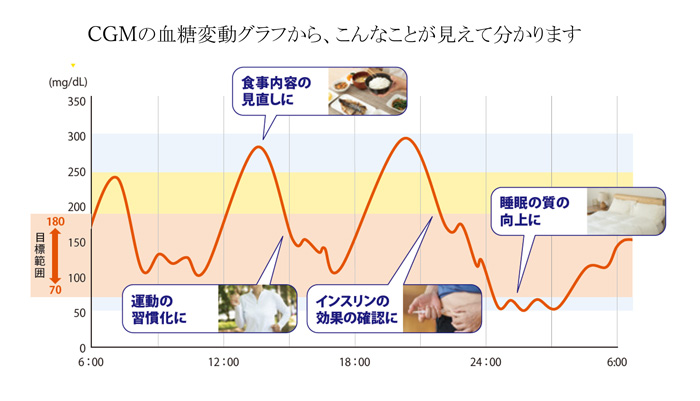 CGMで見えること