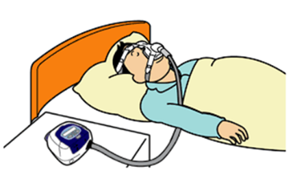 CPAP（シーパップ）を装着して寝る男性のイラスト