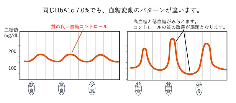 血糖変動のパターン図