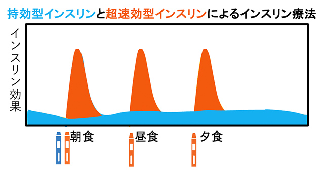 持効型インスリンと超速効型インスリンによるインスリン療法
