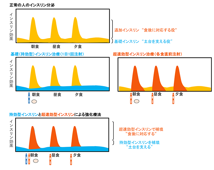 インスリンの種類と使い分け